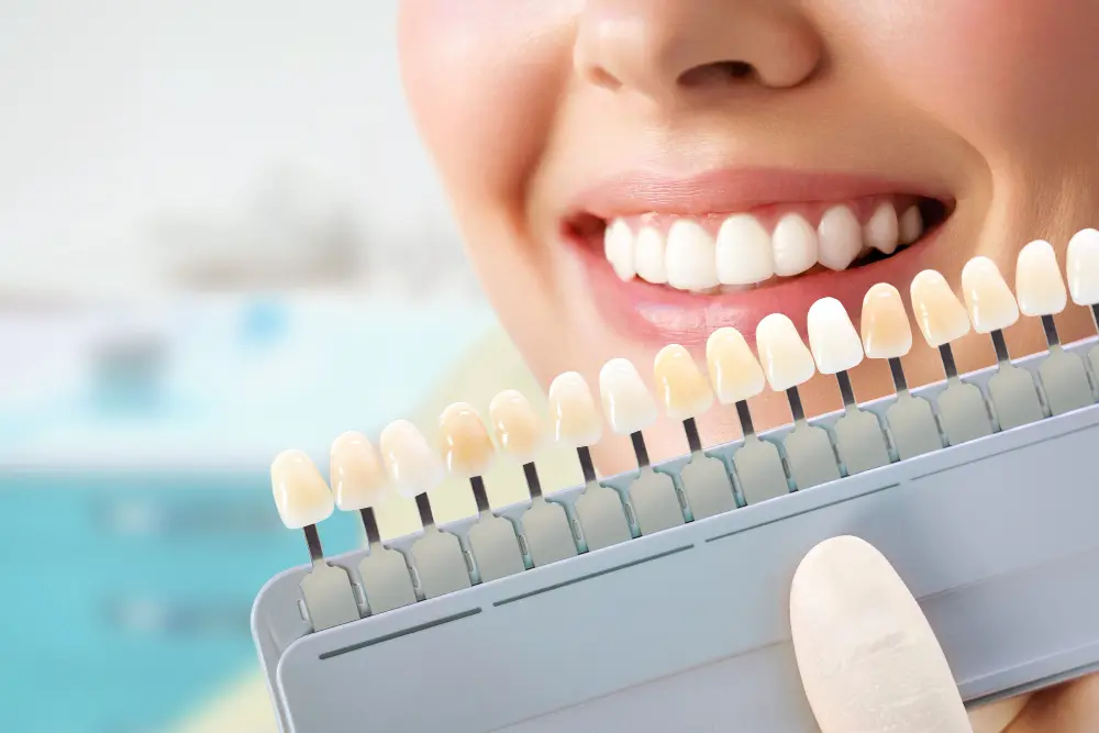 Close up fo woman's smile while looking at shades for veneers at the dentist