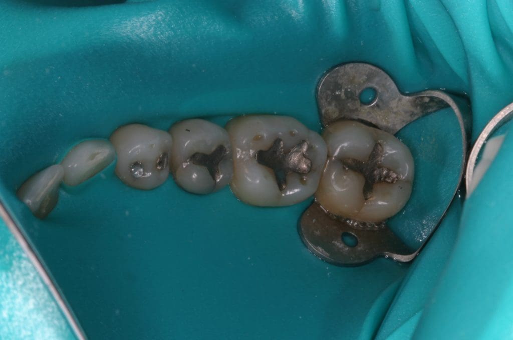 Holistic Dentistry - Wellness Centered Dentistry Holistic Dental care near me, Holistic Tooth Care, Holistic Dentist